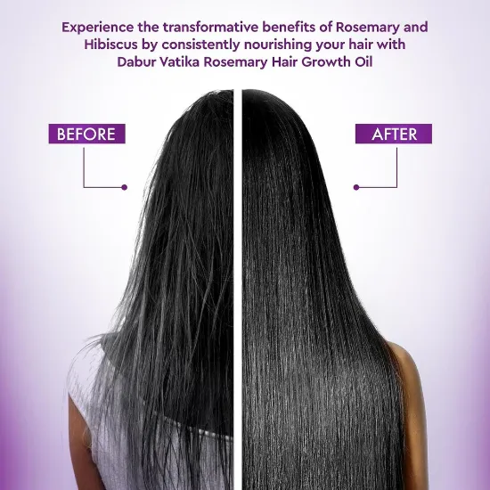 Dabur Vatika Naturals Rosemary Hair Growth Oil - 100ml యొక్క చిత్రం